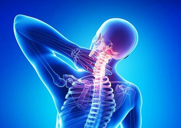 Osteokondrozlu boyun ağrısı