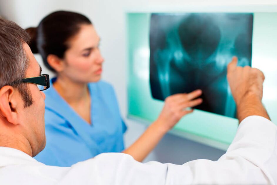 Bir romatolog veya travmatolog kalça eklemindeki ağrıyı teşhis eder. 