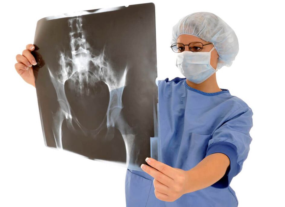 Kalça ekleminin röntgeni, doktorun ağrının nedenini belirlemesine yardımcı olur