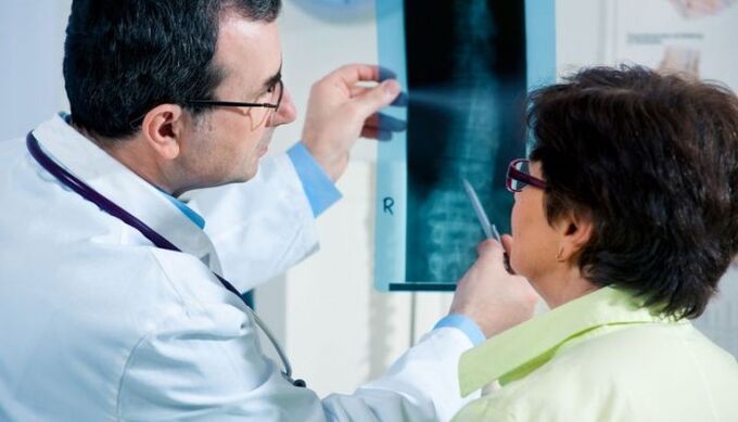 Servikal osteokondroz tanısı için bir yöntem olarak radyografi