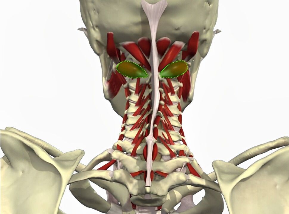Vertebral arter sendromu